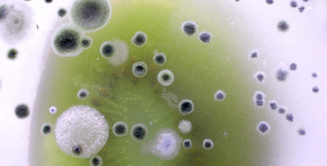Mold Removal in Camarillo, CA